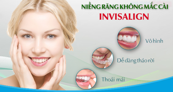 niếng răng insalign