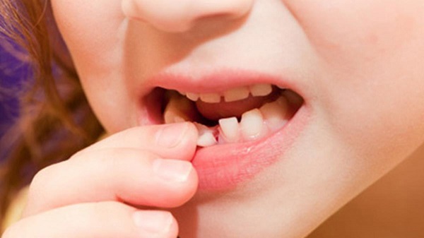 Quá trình thay răng ở trẻ em