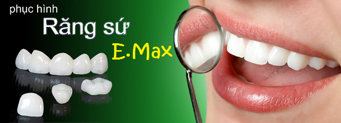 Răng sứ amax có tốt không Răng sứ amax có tốt không