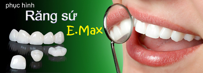 Răng sứ amax có tốt không