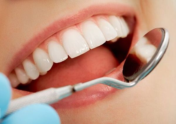 Trồng răng sứ loại nào tốt ?