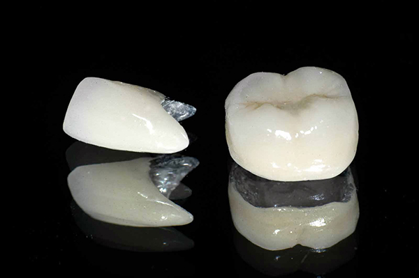 Tìm hiểu về các loại răng sứ trên thị trường hiện nay Tìm hiểu về các loại răng sứ trên thị trường hiện nay