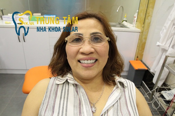 Răng sứ Zirconia thay đổi nụ cười của bạn như thế nào