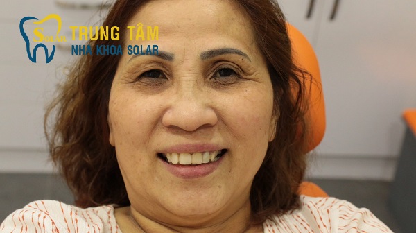 Răng sứ Zirconia thay đổi nụ cười của bạn như thế nào