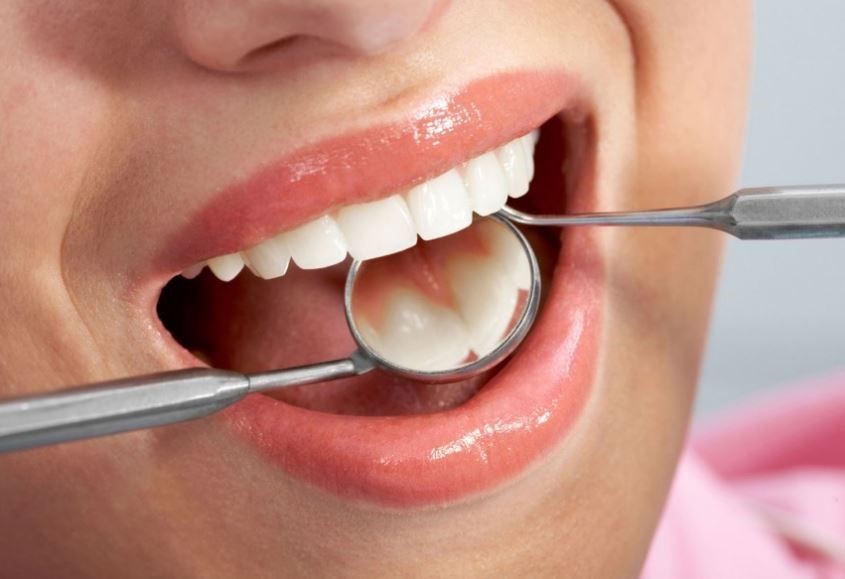 sâu răng và các bệnh lý sâu răng bạn phải biết sâu răng và các bệnh lý sâu răng bạn phải biết