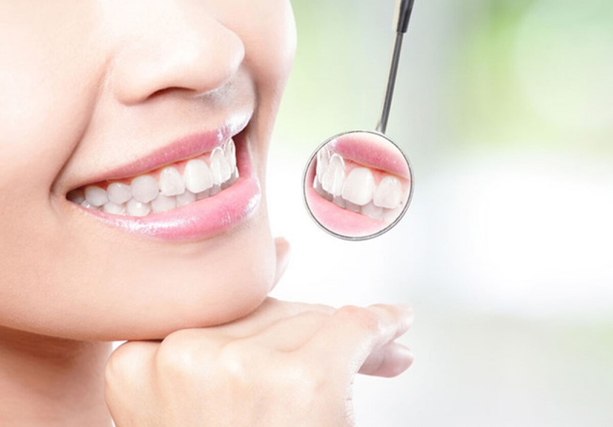 Sâu răng và những vấn đề liên quan mà bạn cần biết