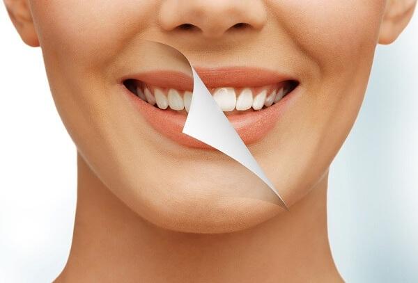 tẩy ttrang răng tẩy ttrang răng