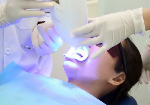 Tẩy trắng răng tại Quận 10 Tẩy trắng răng tại Quận 10