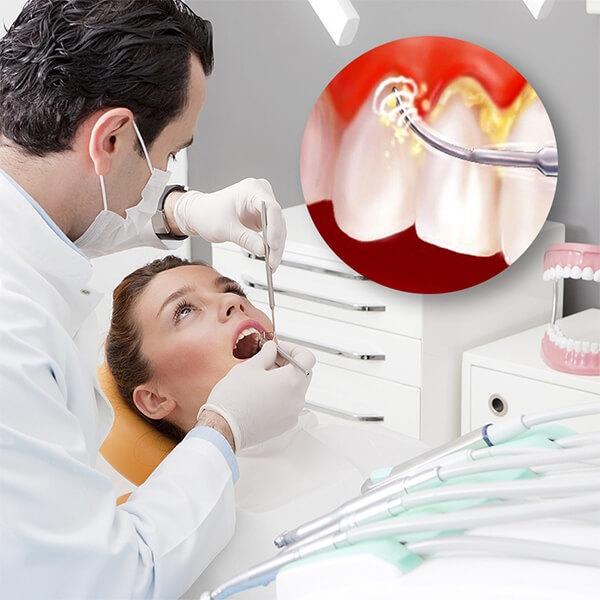 Thần dược giá rẻ trị bách bệnh đặc biệt các vấn đề răng miệng khiến ai cũng không ngờ tới