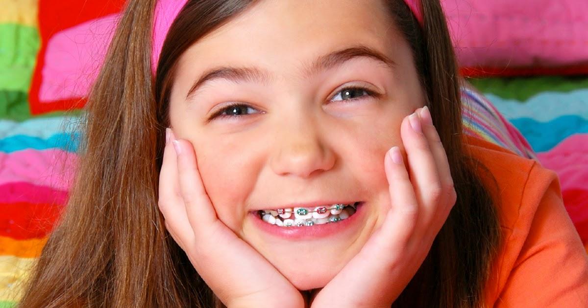 Niềng răng mất bao lâu? Niềng răng mất bao lâu?