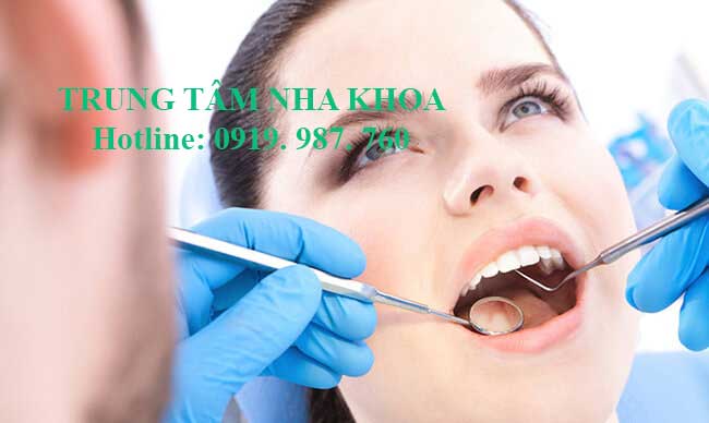 trám răng thẩm mỹ tại nha khoa tân phú