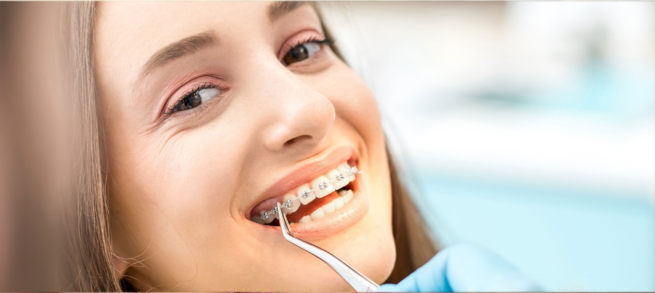 Trưởng thành niềng răng có là quá trễ hay không Trưởng thành niềng răng có là quá trễ hay không