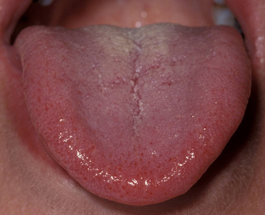 Bệnh về răng Bệnh về răng