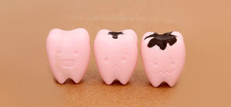 Bệnh về răng Bệnh về răng