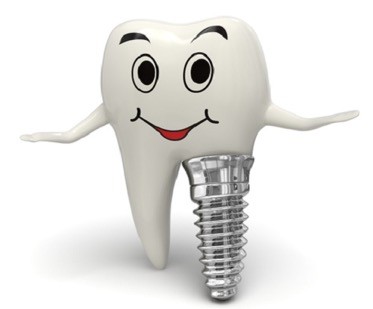 Trồng răng implant Trồng răng implant