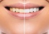 10 bí mật giúp răng bạn luôn trắng sáng