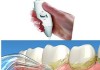 Làm thế nào để loại bỏ mảng bám và vôi răng