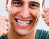 Chăm sóc răng miệng đúng cách trong suốt quá trình niềng răng