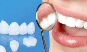 Bọc răng sứ hiệu quả cho những trường hợp răng nào