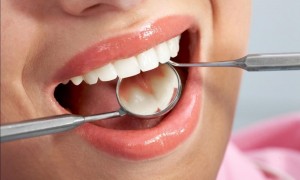 Chữa tuỷ răng mất thời gian bao lâu mới xong?