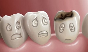 Làm thế nào điều trị răng chết