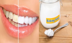 Những chất tốt cho vấn đề răng miệng cần nên tham khảo Hydrogen Peroxide