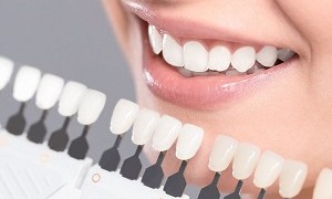 Những nguyên nhân khiến răng bị ố vàng