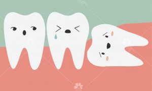 Răng khôn mọc ngầm và những tác hại to lớn mà bạn không biết.
