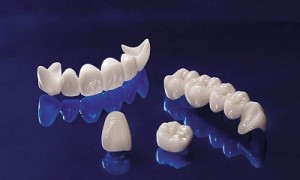 Tìm hiểu về các loại răng sứ  trên thị trường hiện nay