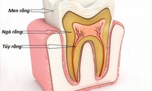 Viêm tủy răng và những dấu hiệu mà bạn nên biết